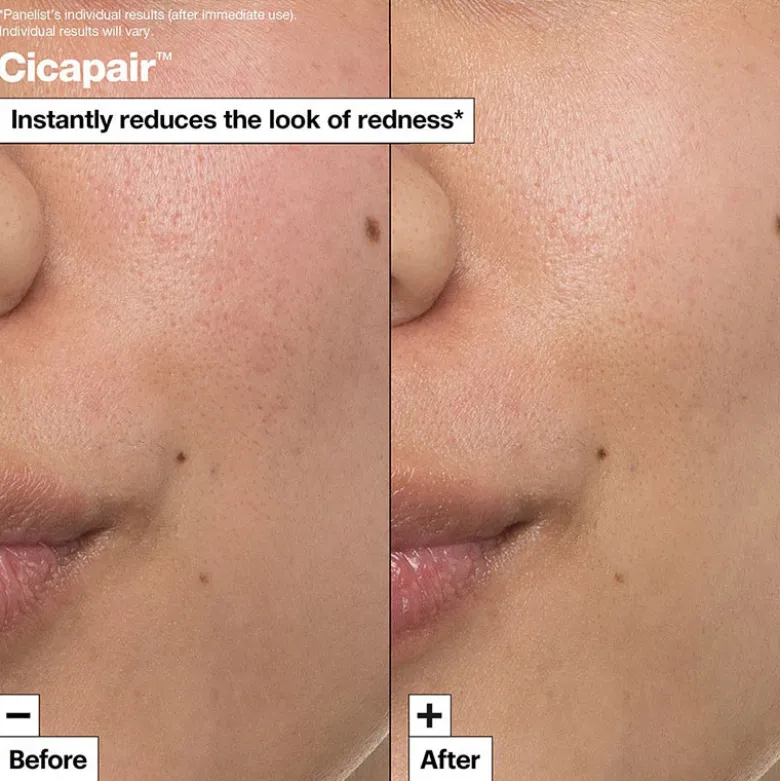Cicapair™ Intensive Soothing Repair Cream