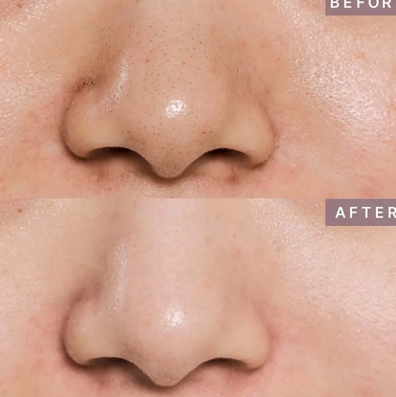 Pot Pore Peptamin Wash Off Pack