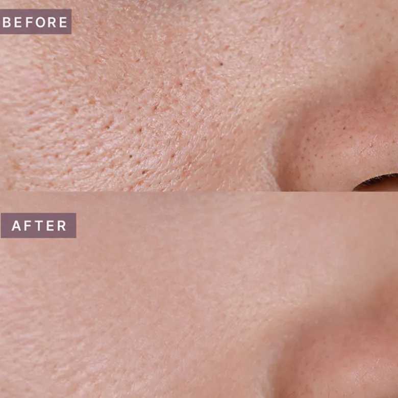 Pot Pore Tightening Podo Ampoule