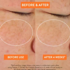 Radian-C Cream
