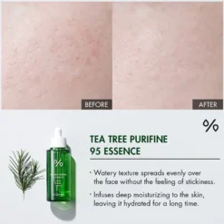 Tea Tree Purifine 95 Essence